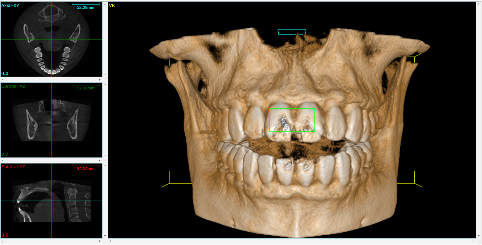 Cone Beam 3D Imaging Lynden, WA