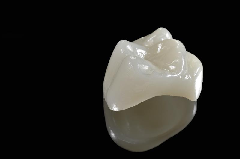 Porcelain Crowns  Lynden, WA